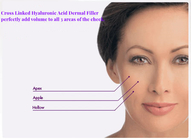 顔の不況の傷を減らすための安全で有効なHAのゲルの皮膚注入口