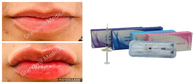唇の十分の顔のしわのための十字つながれたナトリウムのHyaluronic酸の注入の皮膚注入口