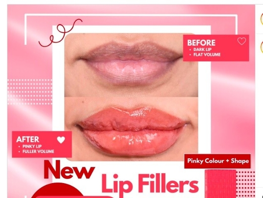 HYDROIAM Kiss with B12 Ha Filler Red Lips Filler ハイアルロン酸のフィルラー 自然な体積と色を提供します