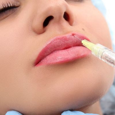 ゲルの形態の注射可能な唇の注入口24mg/MlのHyaluronic酸の自然