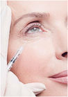 Hyaluronic酸の注入の皮膚注入口は目袋および暗い円を取除く