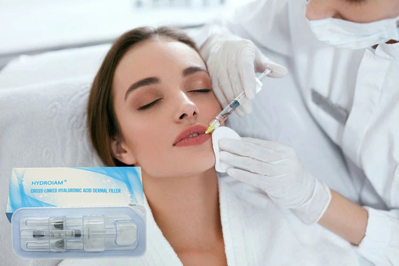 非外科唇の強化の注入口のHyaluronic酸の唇の注入
